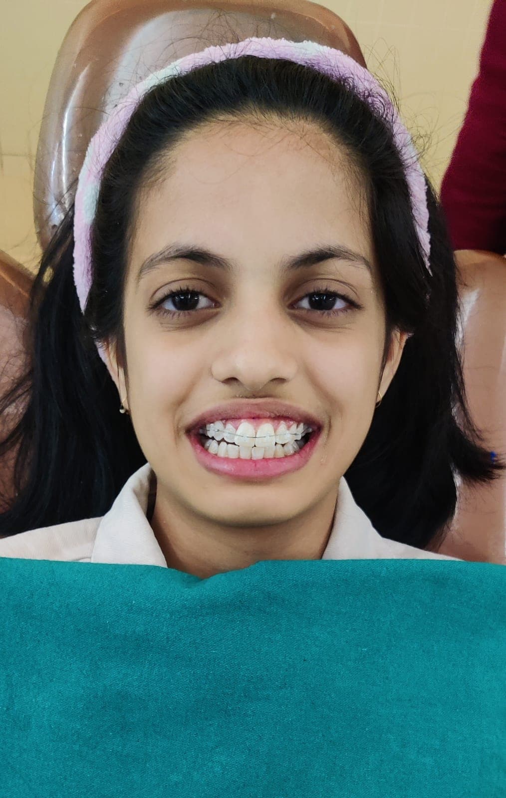 Patient Smile #2