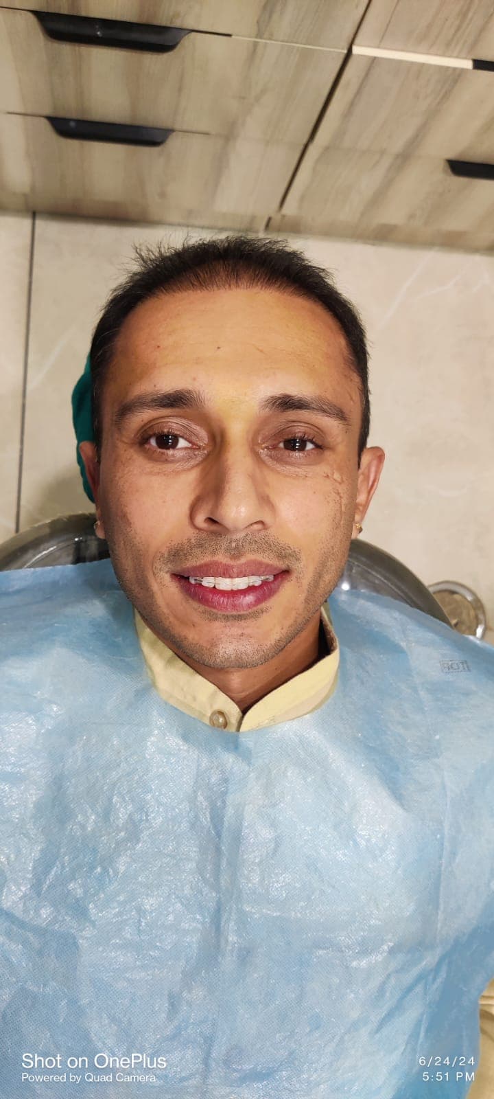Patient Smile #4