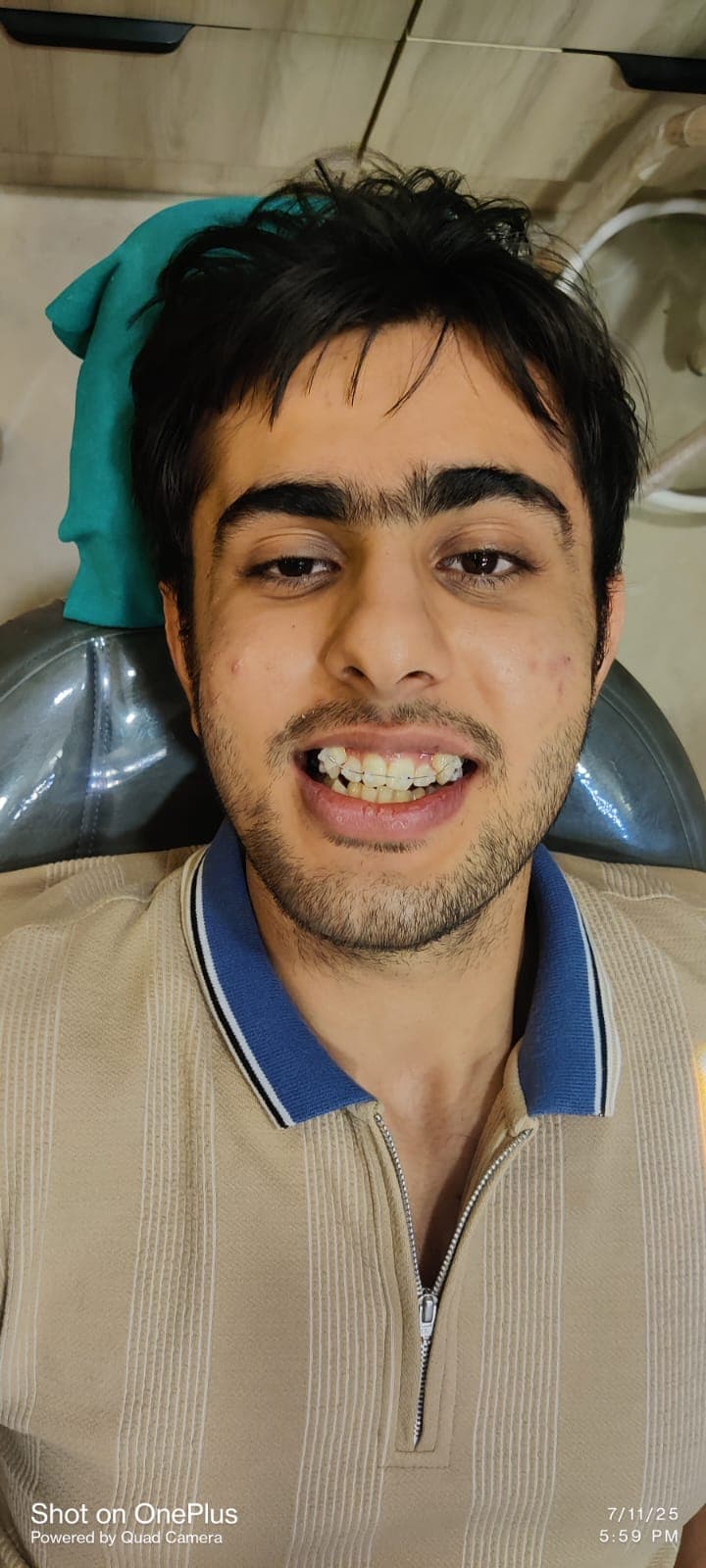 Patient Smile #10