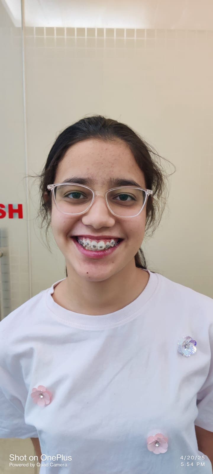 Patient Smile #14