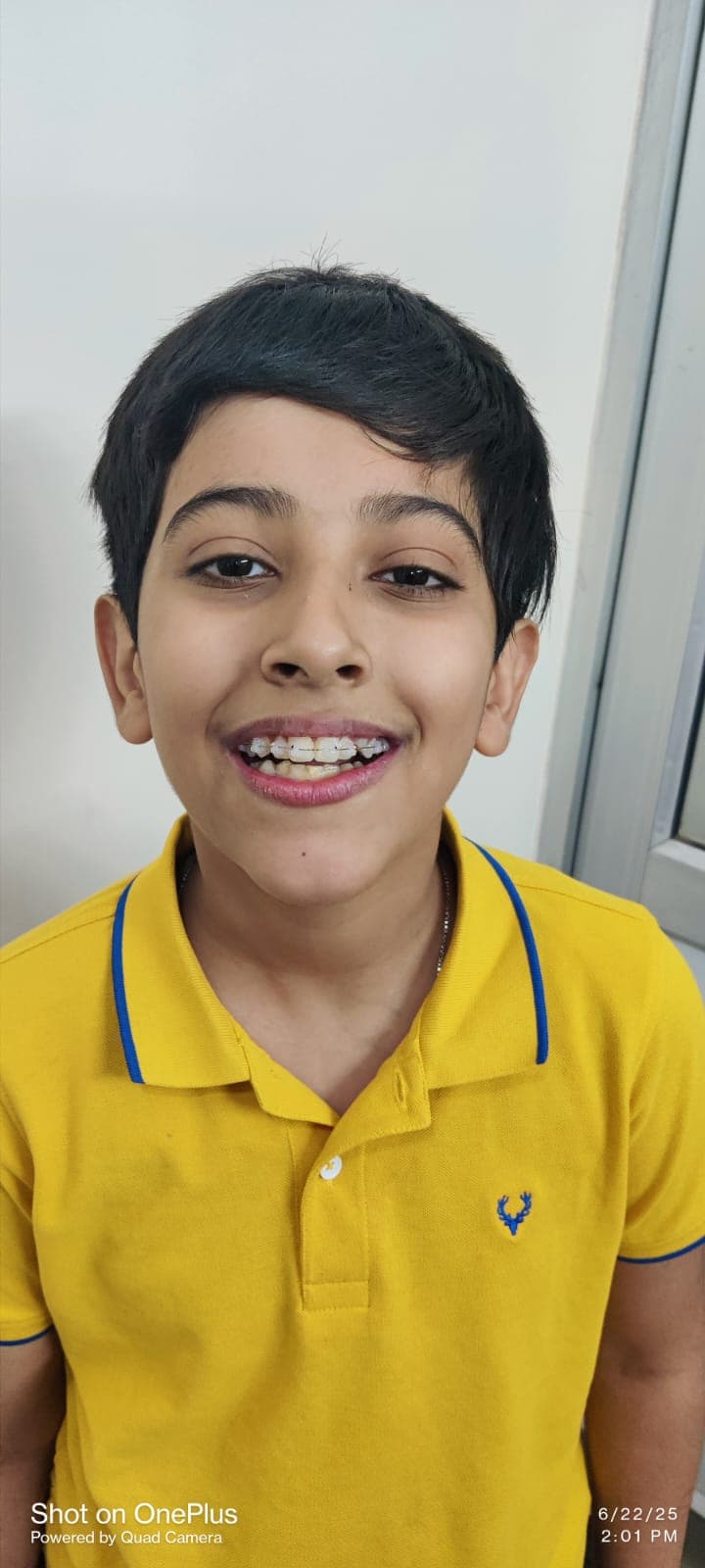 Patient Smile #37