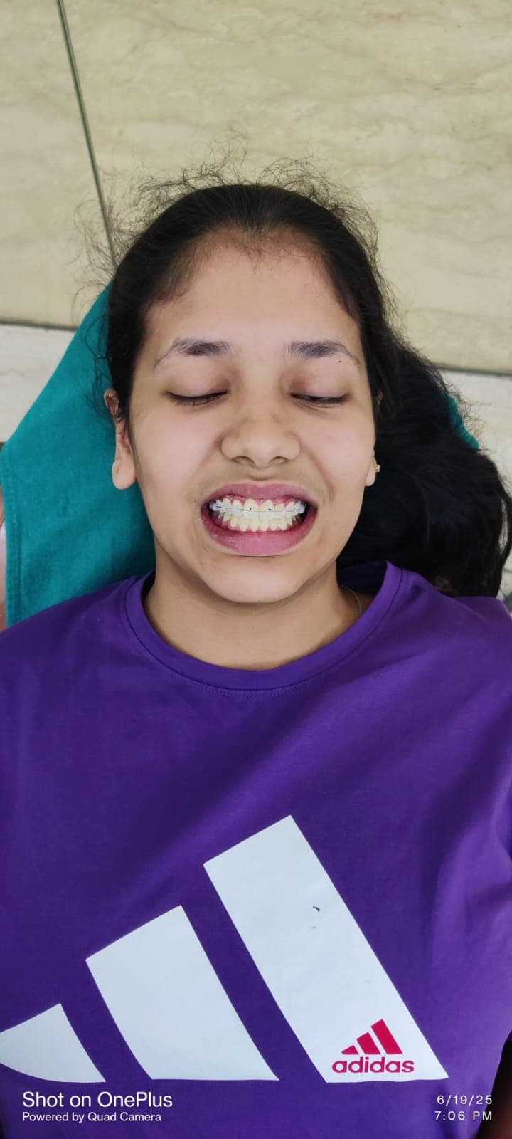 Patient Smile #48