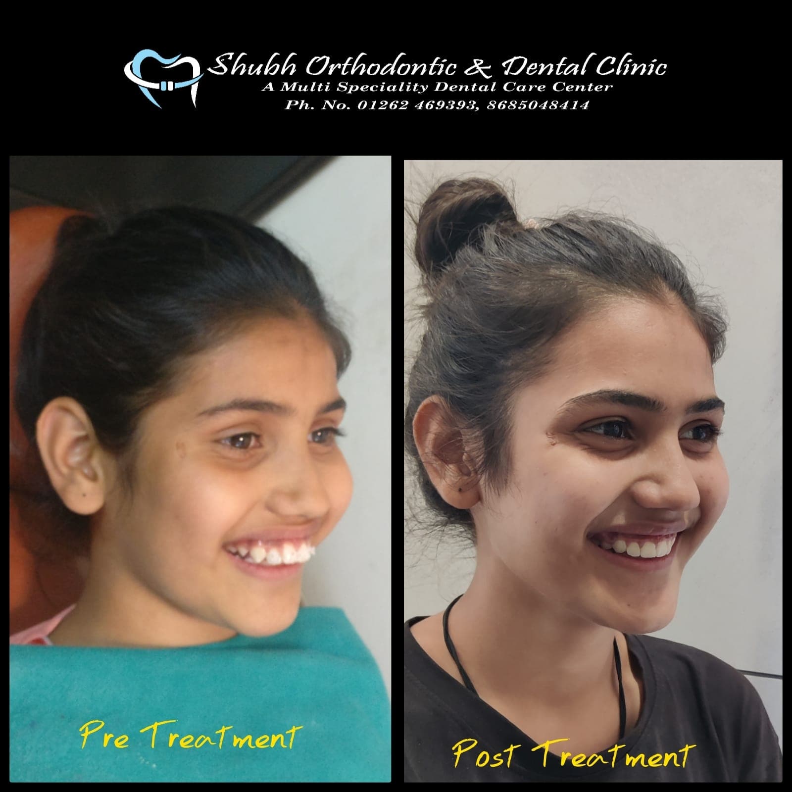 Smile Transformation #8
